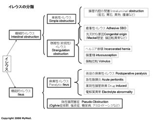 桂歌丸さん入院 腸閉塞 イレウス の恐ろしさ